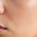 Peau sensible : quels soins choisir et lesquels éviter