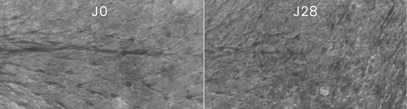 TEST CLINIQUES & RESULTATS PERCUS